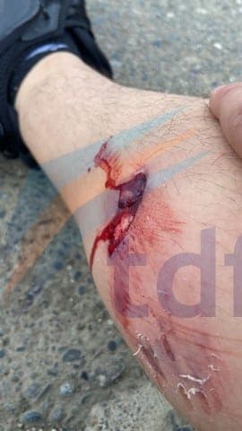 Grave ataque de un perro suelto a un joven en Río Grande